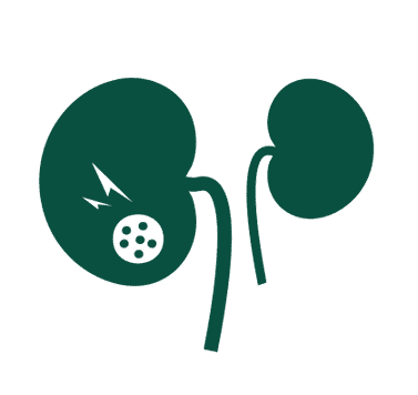 Proteinuria