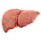 fattyliver