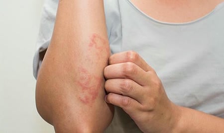 ayurvedictreatment