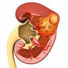 kidney