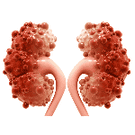 kidney