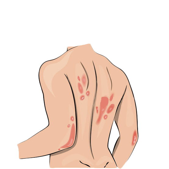 karma ayurvedic treatment