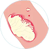 ayurvedictreatment