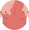 ayurvedictreatment
