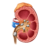 kidney