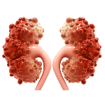kidney