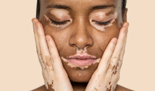 ayurvedictreatment