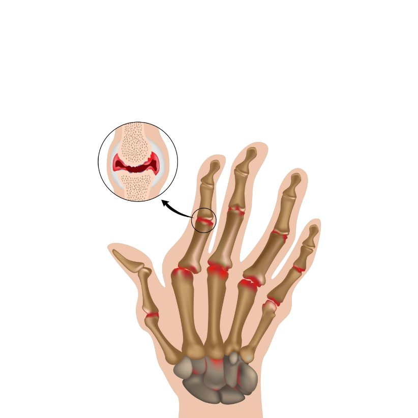 karma ayurvedic treatment