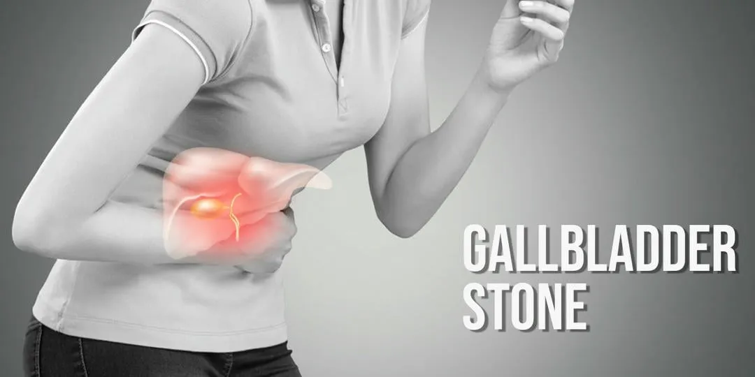 ayurvedic-cure-for-gallstones