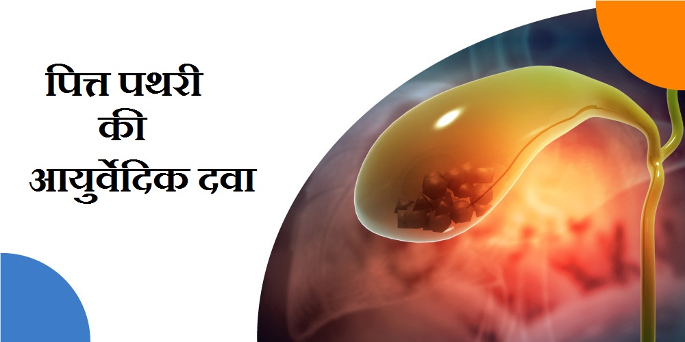 पित्त-पथरी-की-आयुर्वेदिक-दवा