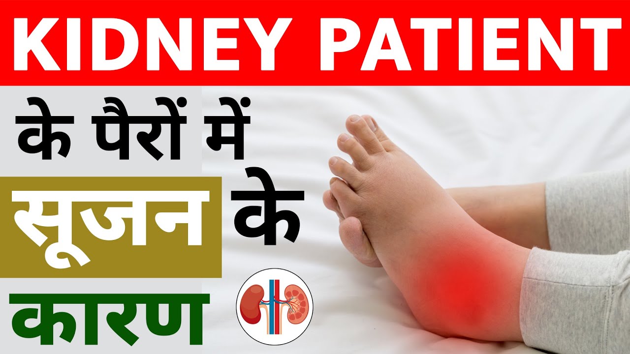 पैरों-में-सूजन-की-आयुर्वेदिक-दवा