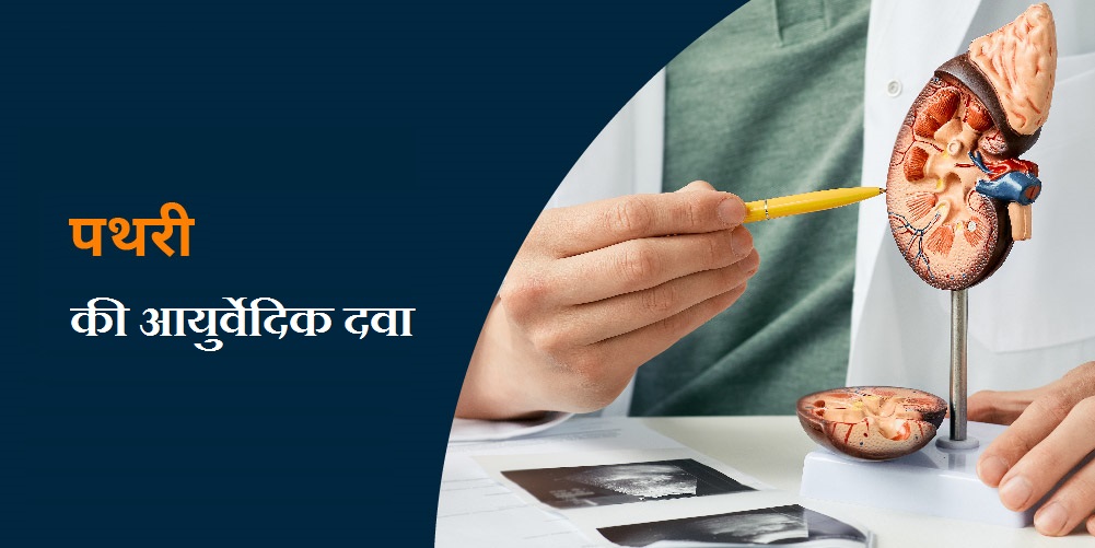 पथरी-की-दवा-आयुर्वेदिक