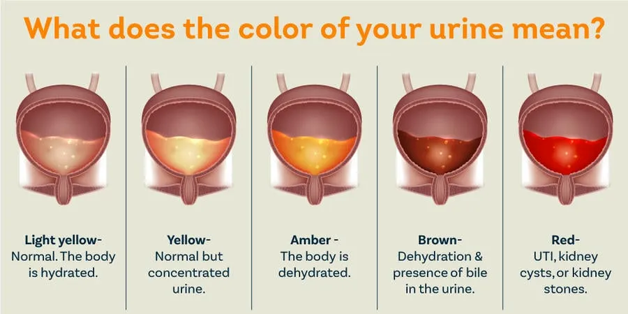 Hematuria: Cure with Ayurvedic remedies, symptoms, causes