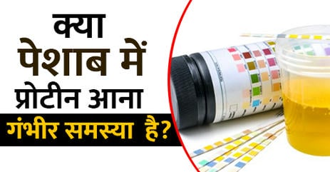 आयुर्वेद-में-पेशाब-में-प्रोटीन-आने-का-इलाज