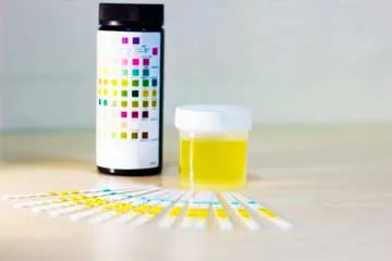 proteinuria-ayurvedic-treatment