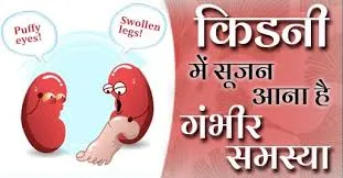 किडनी में सूजन क्यों होती है?