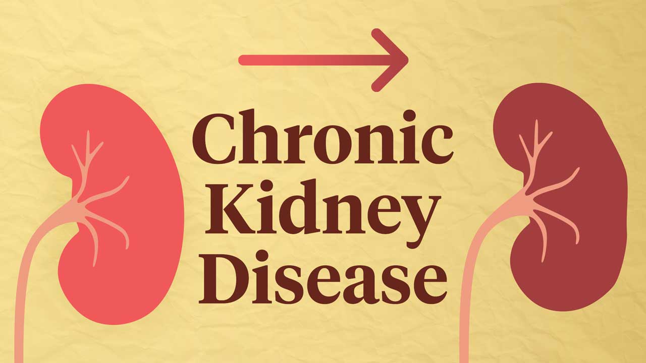ayurvedic-treatment-for-ckd