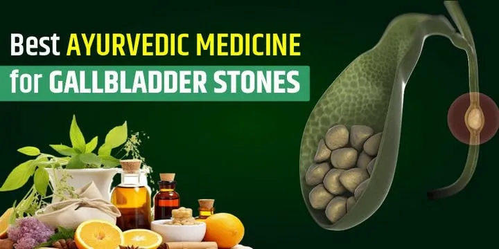 Best Ayurvedic Medicine For Gallbladder Stones