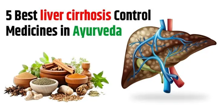 5 Best Liver Cirrhosis Control Medicines in Ayurveda