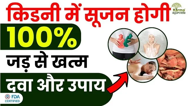 किडनी में सूजन आने के 5 आयुर्वेदिक उपचार