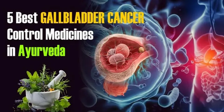 5 Best Gallbladder Cancer Control Medicines in Ayurveda