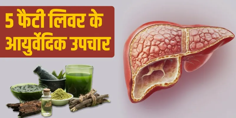 फैटी-लिवर-के-आयुर्वेदिक-उपचार