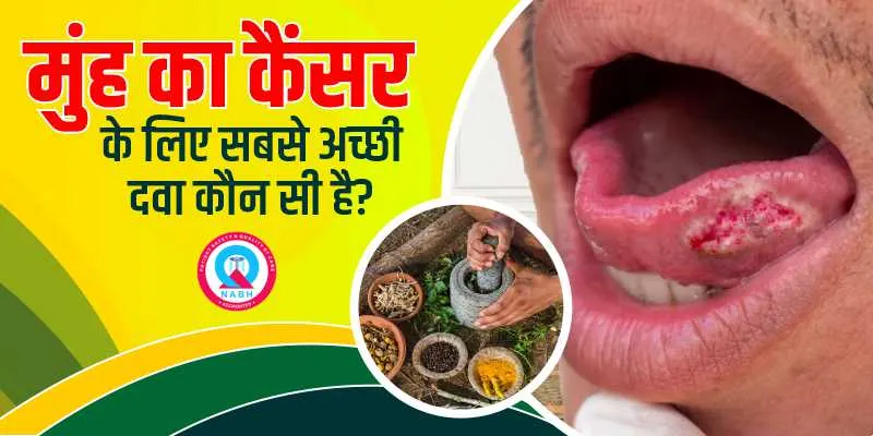 मुंह-का-कैंसर-के-लिए-सबसे-अच्छी-दवा-कौन-सी-है