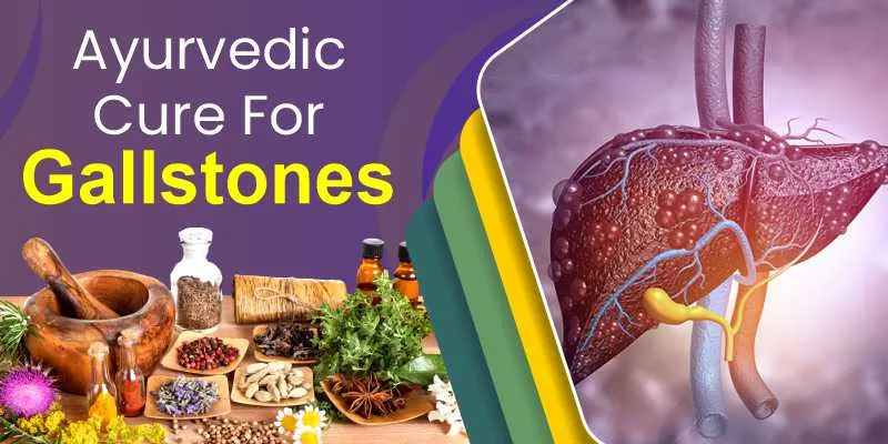 Ayurvedic Cure For Gallstones