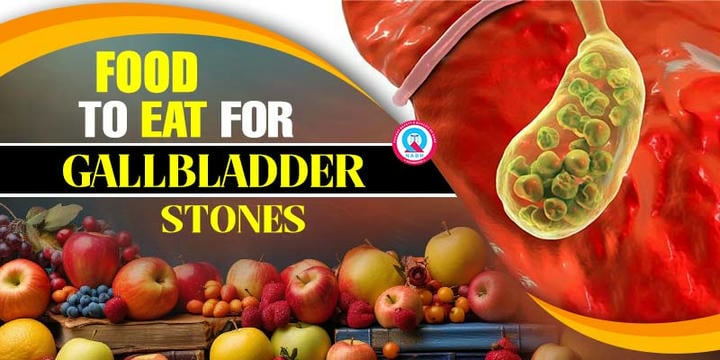 food-to-eat-for-gallbladder-stones
