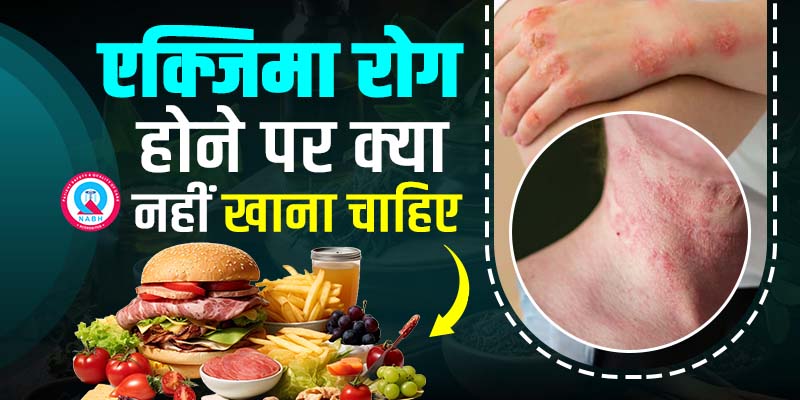 एक्जिमा-रोग-होने-पर-क्या-नहीं-खाना-चाहिए