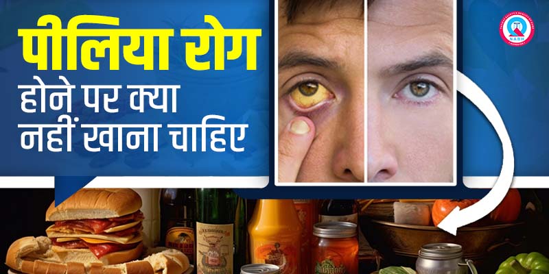 पीलिया-रोग-होने-पर-क्या-नहीं-खाना-चाहिए