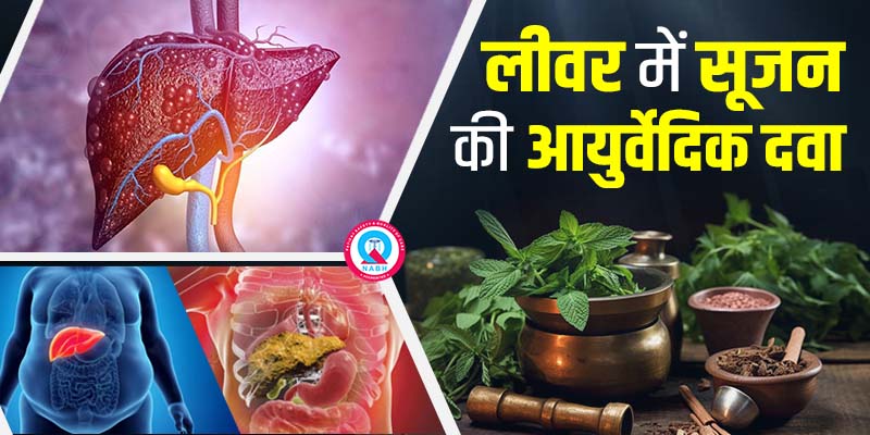 लीवर-में-सूजन-की-आयुर्वेदिक-दवा
