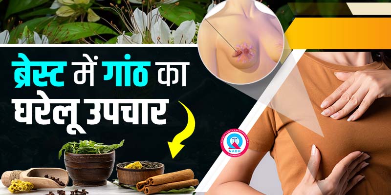 ब्रेस्ट में गांठ का घरेलू उपचार