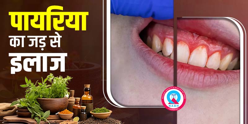 पायरिया-का-जड़-से-इलाज
