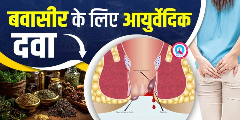 बवासीर के लिए आयुर्वेदिक दवा