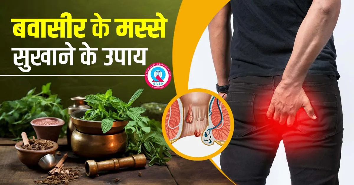 बवासीर-के-मस्से-सुखाने-के-उपाय