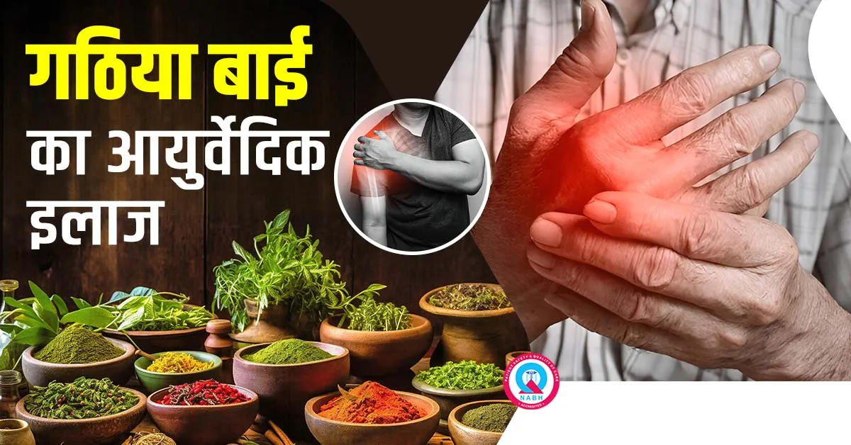 गठिया बाई का आयुर्वेदिक इलाज