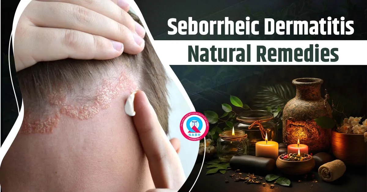 seborrheic-dermatitis-natural-remedies