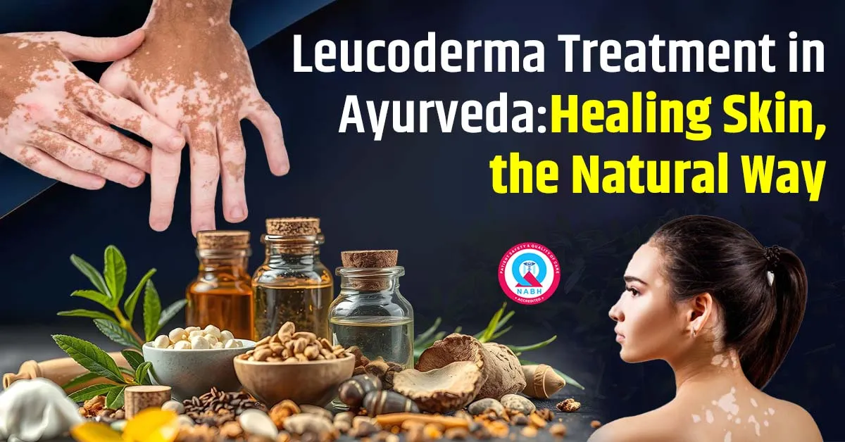 leucoderma-treatment-in-ayurveda