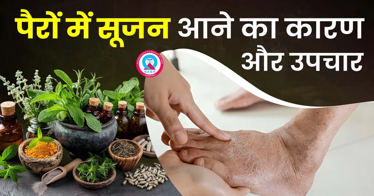 पैरों-में-सूजन-आने-का-कारण-और-उपचार
