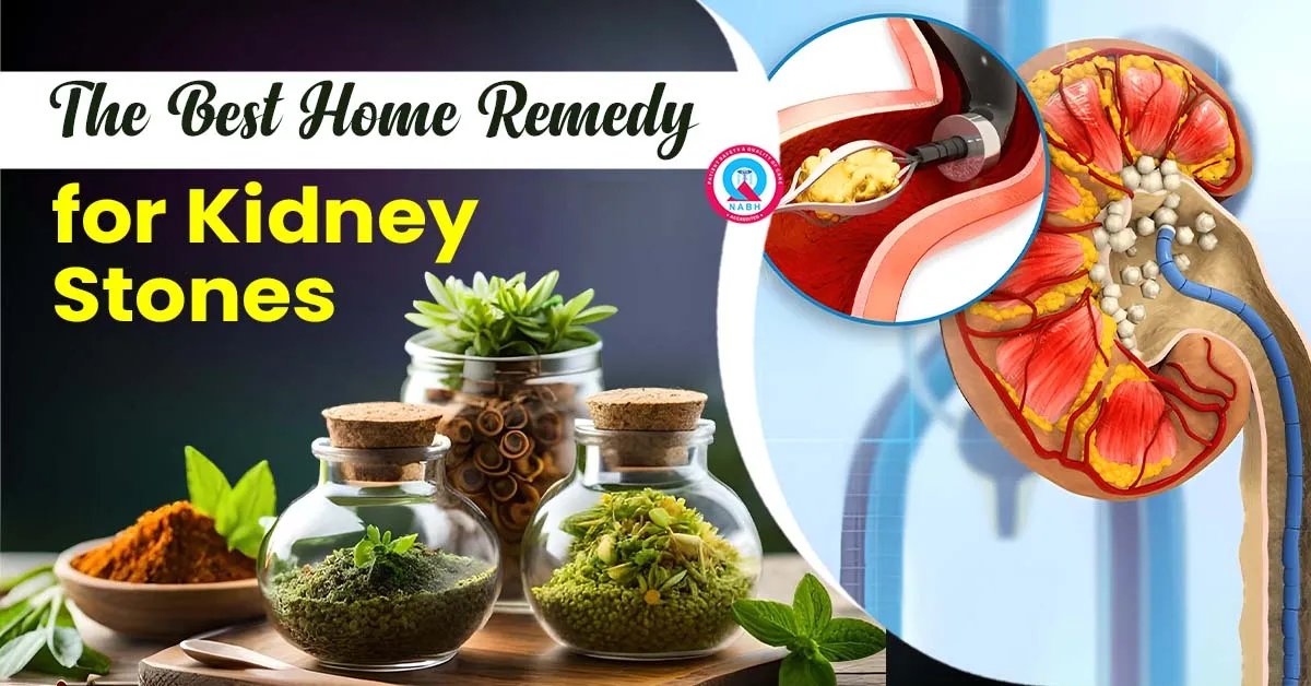 Flush 'Em Out: The Best Home Remedy for Kidney Stones