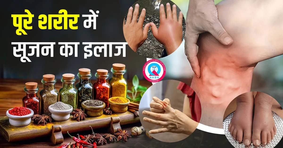 पूरे-शरीर-में-सूजन-का-इलाज