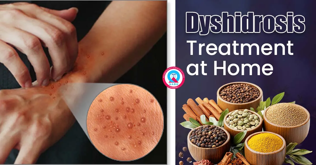 dyshidrosis-treatment-at-home