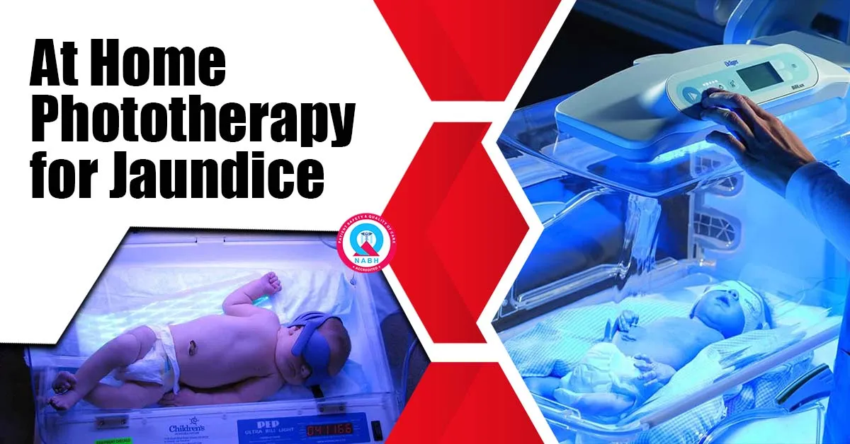 at-home-phototherapy-for-jaundice