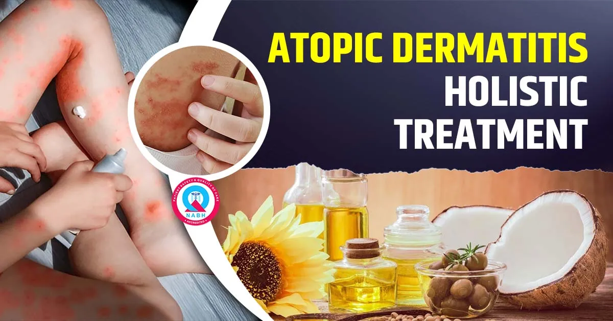atopic-dermatitis-holistic-treatment