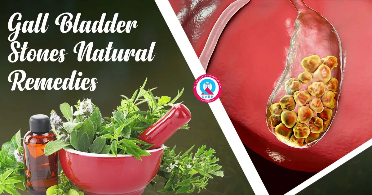 gall-bladder-stone-natural-remedies