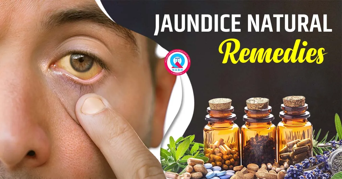 jaundice-natural-remedies