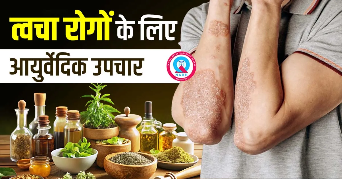 त्वचा-रोगों-के-लिए-आयुर्वेदिक-उपचार