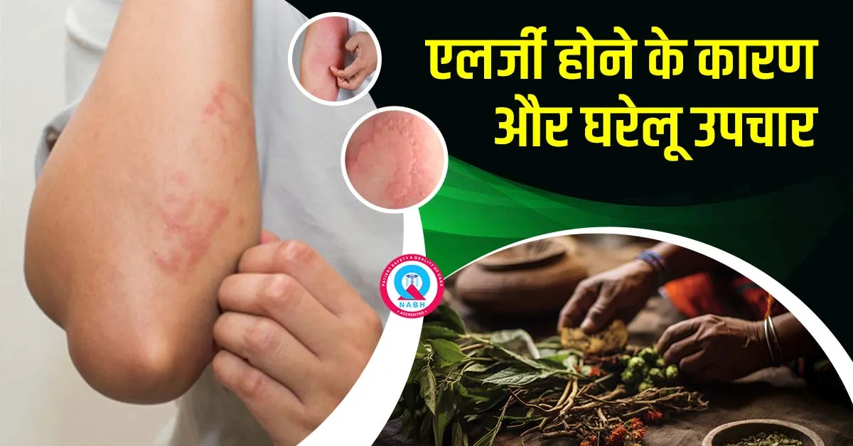 एलर्जी-होने-के-कारण-और-घरेलू-उपचार