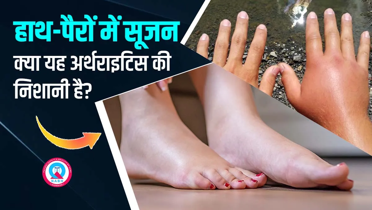 हाथ-पैरों-में-सूजन-क्या-यह-अर्थराइटिस-की-निशानी-है